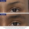 Obagi Nu-Cil™ Eyebrow Boosting Serum