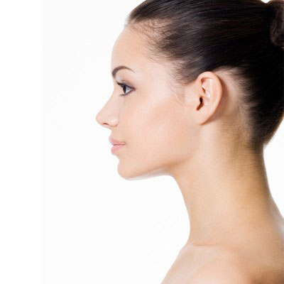 Septoplasty